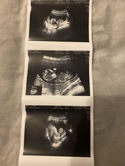 Gender predictions ??