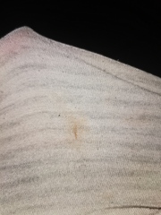 Spotting or dried discharge? TMI