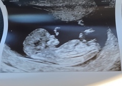 Do you want me to guess the sex? 12 week scans.