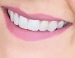 AIBU to feel cheated about DD's teeth? (Pic included)