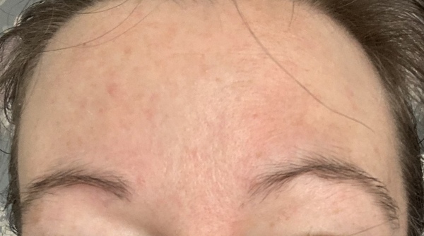 Skin gurus I need you! 30s skin HELP?!