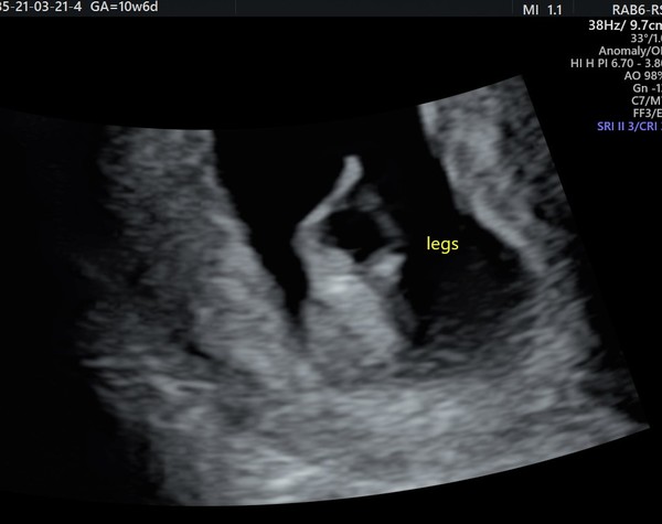 October 2021