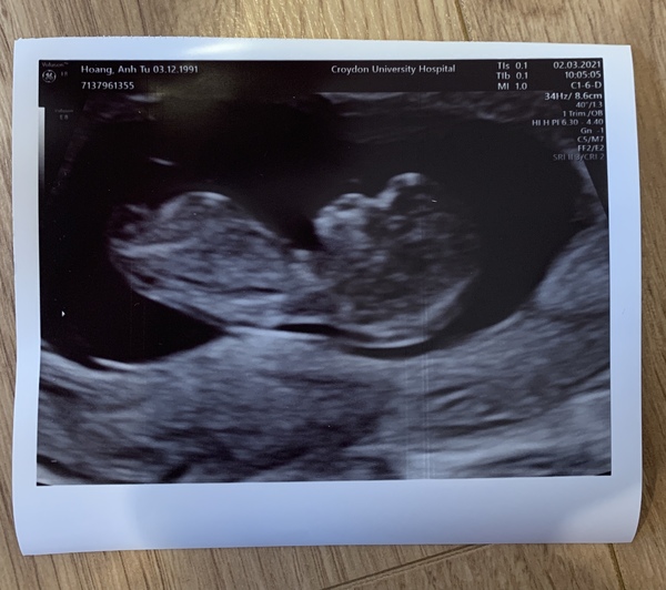 Do you want me to guess the sex? 12 week scans.