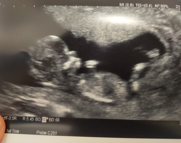 September 2021 thread 3 🥳
