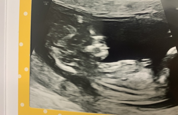 Aug 2021 - 2nd Trimester continues