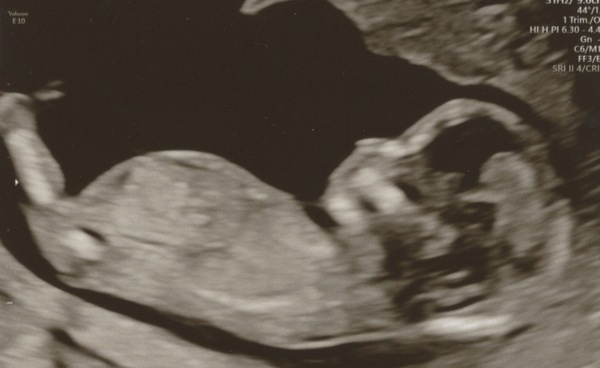 August 2021 - Heading into the second trimester