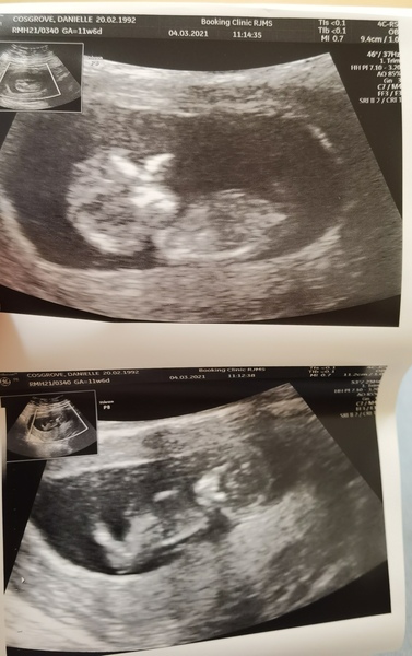 Do you want me to guess the sex? 12 week scans.