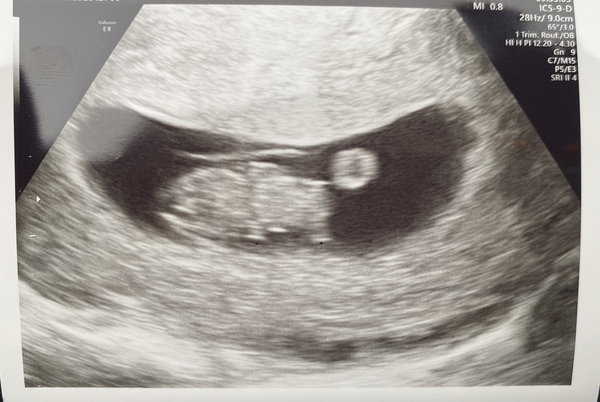 September 2021 thread 3 🥳