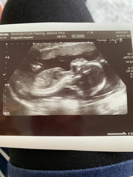 Aug 2021 - 2nd Trimester continues