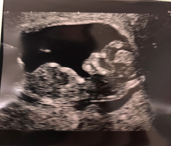 Gender Guess!
