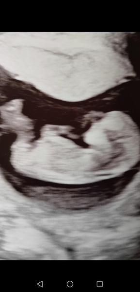 September 2021 thread 3 🥳