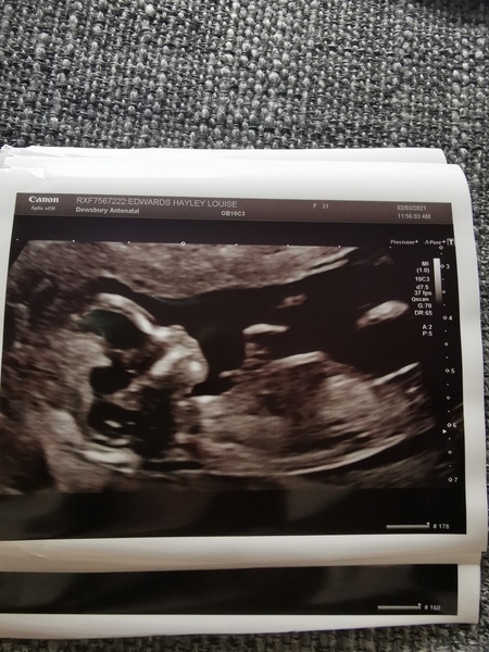 Do you want me to guess the sex? 12 week scans.