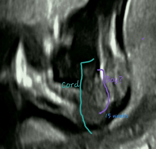 15 week scan images...