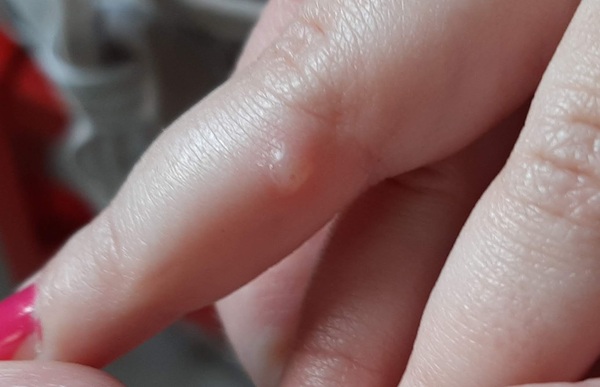 What’s this on DD’s finger? (Pic included)