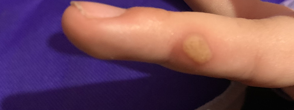 What’s this on DD’s finger? (Pic included)