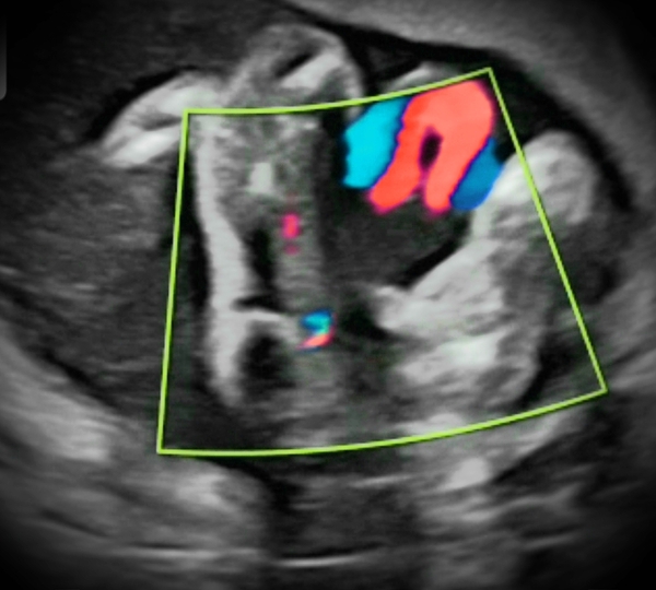 15 week scan images...