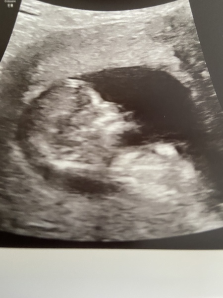 Crazy Gang Bumps and Babies