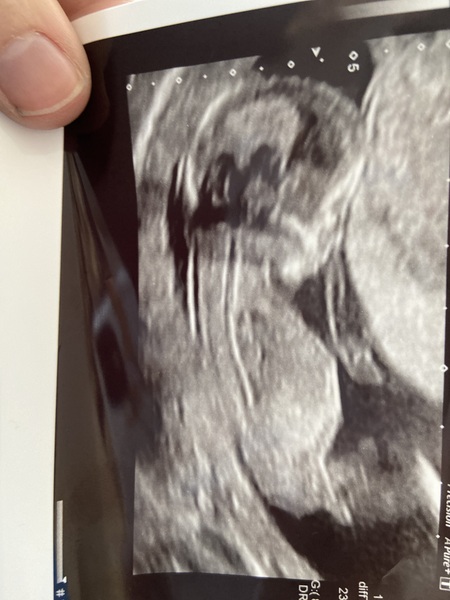 Gender guesses?