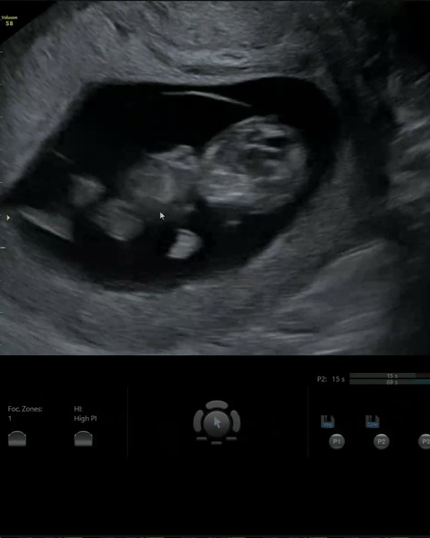 Due Sept/Oct 2021