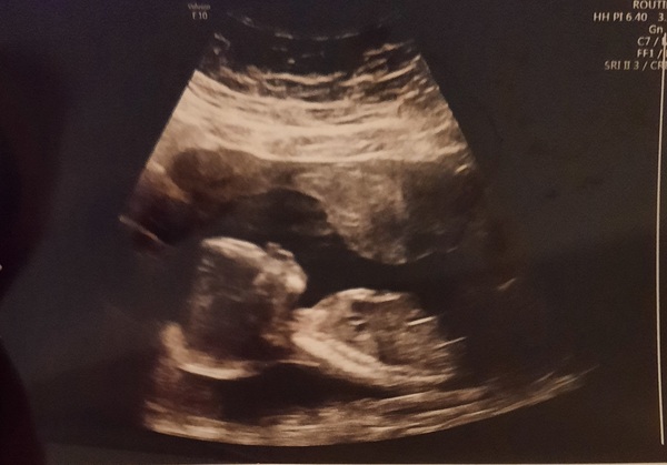 August 2021 - Heading into the second trimester