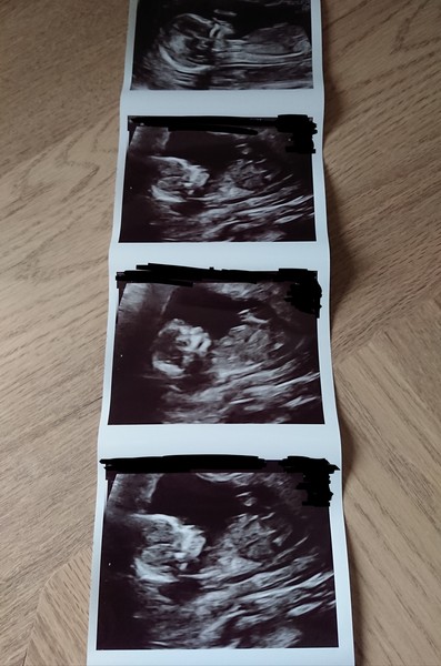 Do you want me to guess the sex? 12 week scans.