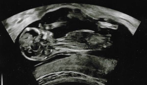Do you want me to guess the sex? 12 week scans.