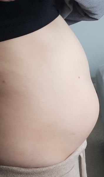 Bump not round