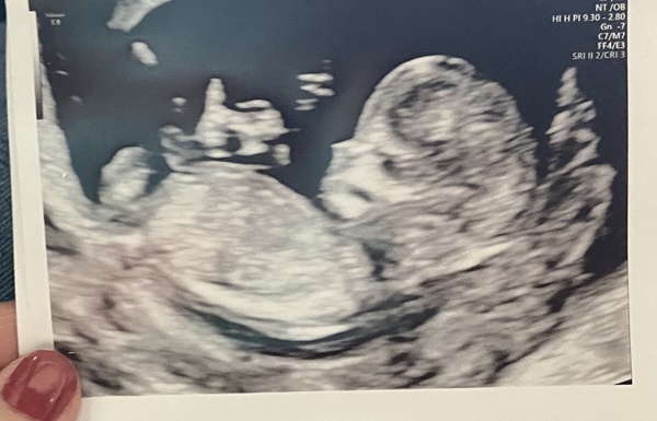 September 2021 thread 2🥳
