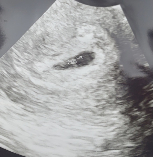 Due November 2021 - thread 2!