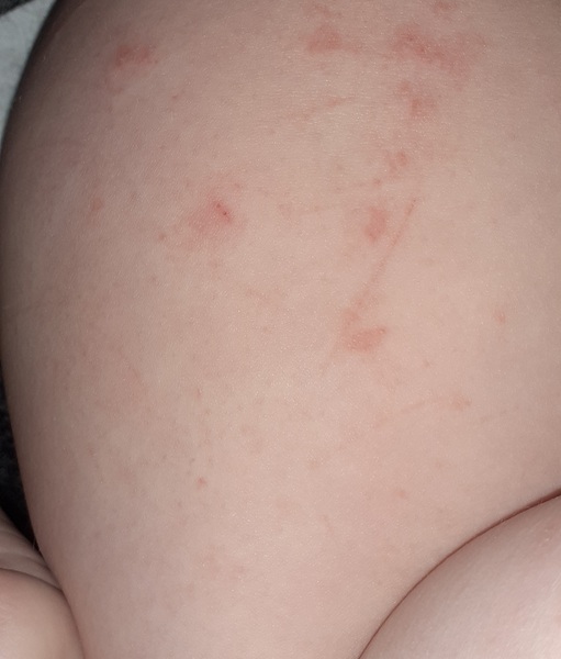 Weird spots/rash?