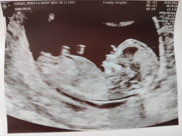 Do you want me to guess the sex? 12 week scans.