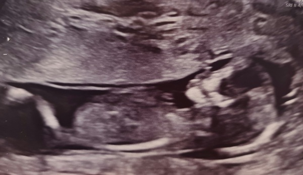 October 2021 - part 2