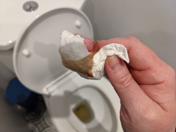What's this (warning,  gross picture of discharge. sorry)