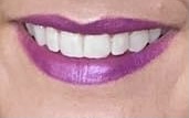 AIBU to feel cheated about DD's teeth? (Pic included)