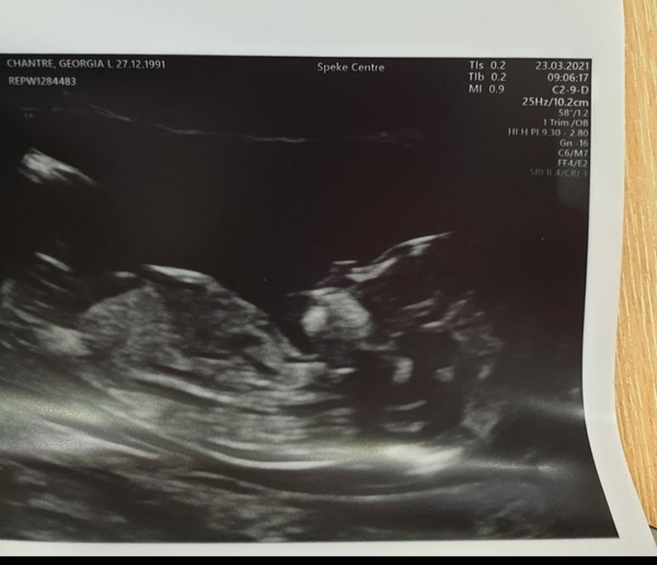 September 2021 thread 3 🥳