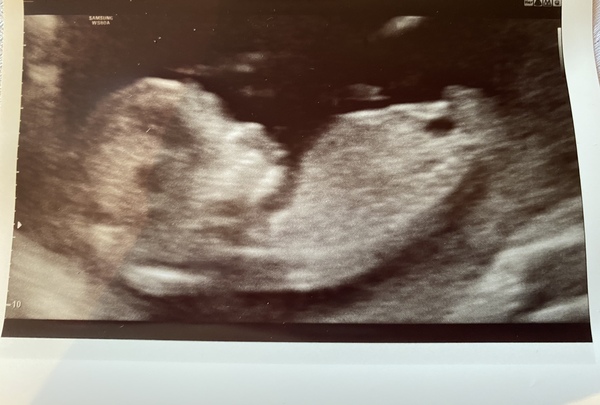 Do you want me to guess the sex? 12 week scans.