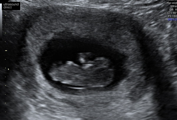 Gender guess?!