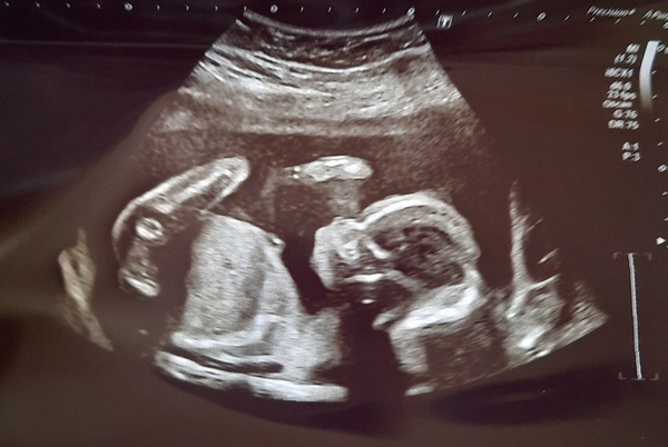 Aug 2021 - 2nd Trimester continues