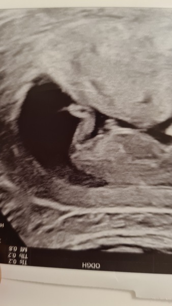 Do you want me to guess the sex? 12 week scans.