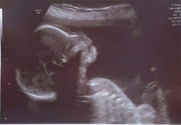 Aug 2021 - 2nd Trimester continues