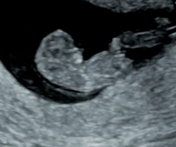 Gender guess...?