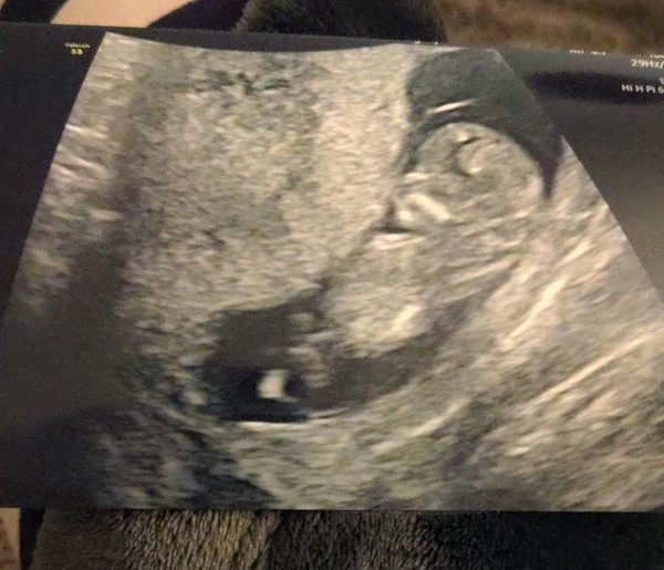 September 2021 thread 3 🥳