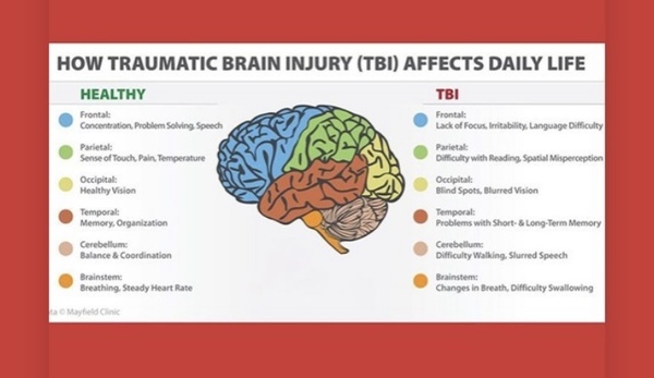 Dd - possible brain injury, feel like she’s being fobbed off.