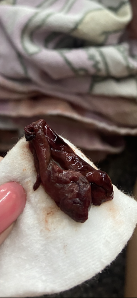 Is this my baby? Pictures included sorry for tmi