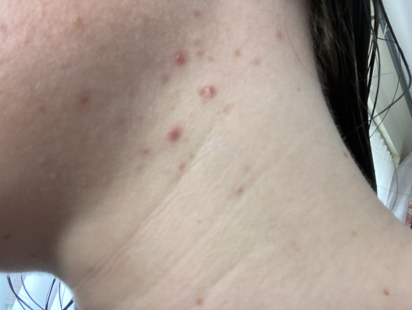My skin- does this need investigated?