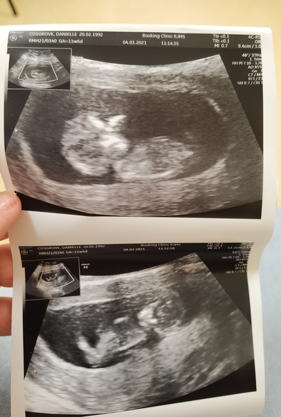 Do you want me to guess the sex? 12 week scans.