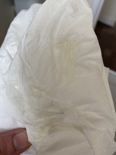 Mucous plug?? TMI pic!!