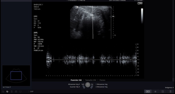 Confused and londely- early loss