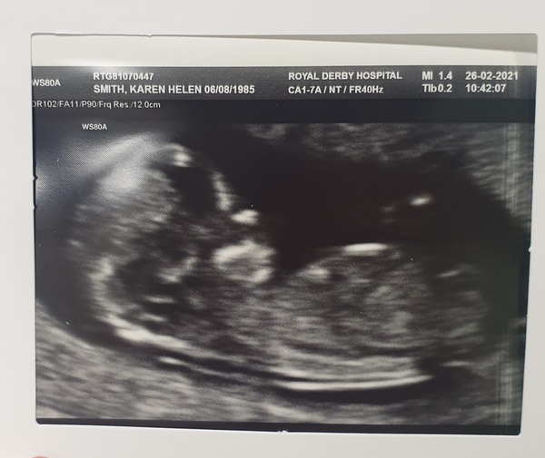 Do you want me to guess the sex? 12 week scans.