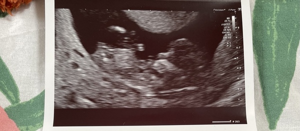 Do you want me to guess the sex? 12 week scans.
